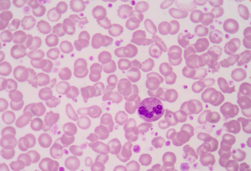 Fond anormal de la science de globules rouges photo stock