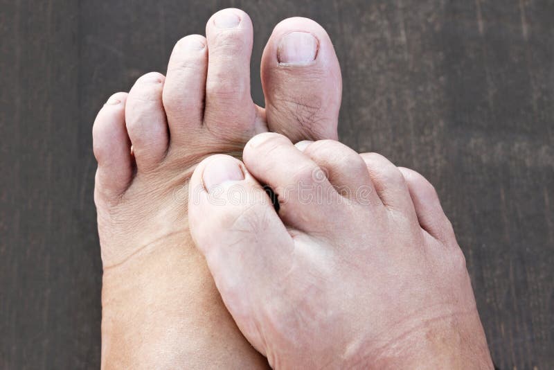 Foot and bacteria. stock photo. Image of body, foot 107003772