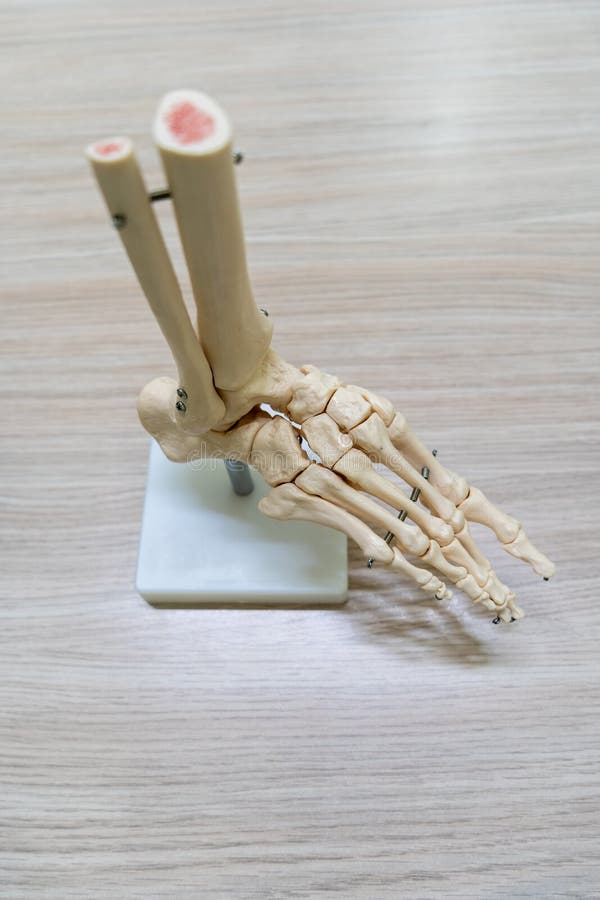 X ray Foot Bone Fracture Base of Metatarsal Fracture from Traumatic