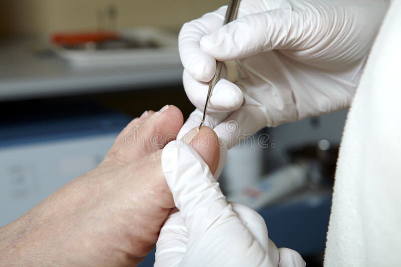 Foot Care Pedicure Chiropody Stock Photo Image of chiropody