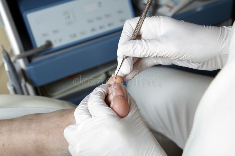Foot Care Pedicure Chiropody Stock Image Image of healthcare