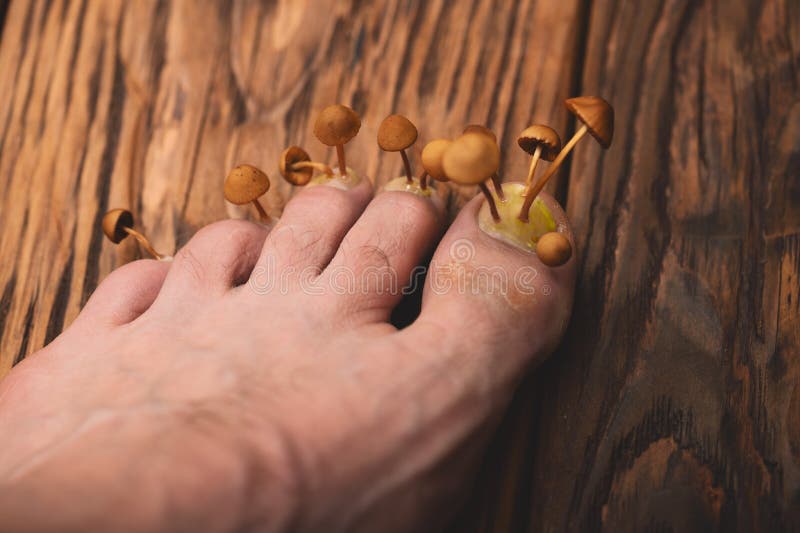 Can Mushrooms Grow on Feet? 