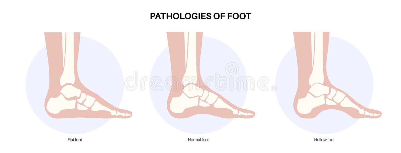 Supination Stock Illustrations – 121 Supination Stock