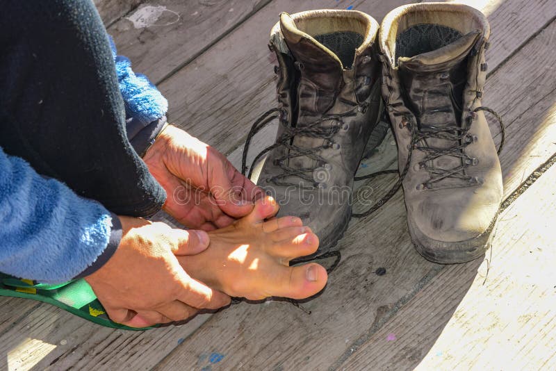 Foot Problems on a Mountain Hike 2017 Stock Image Image of injured