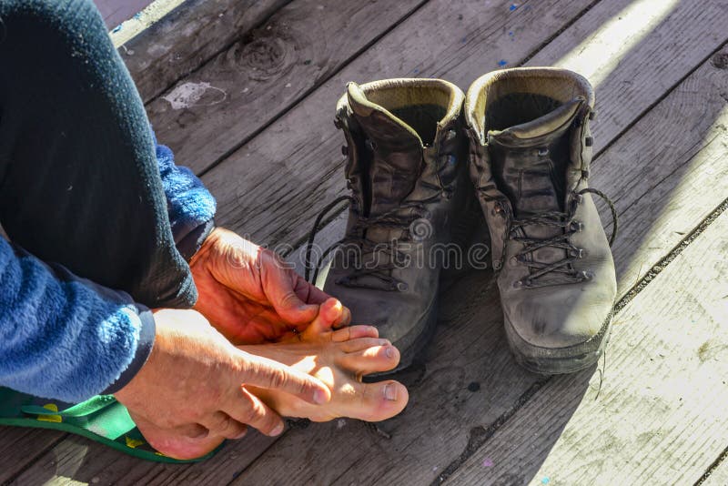 Foot Problems on a Mountain Hike 2017 Stock Photo Image of hand, fall