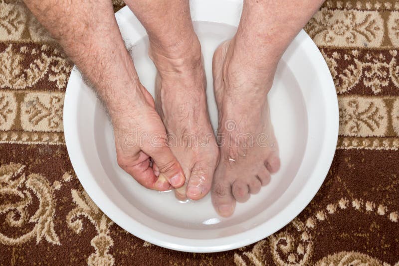 Hammer toe feet stock image. Image of disease, deformation - 177497343