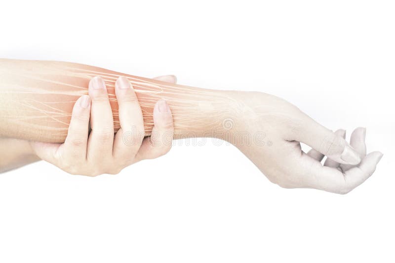 Forearm muscle injury stock photo. Image of nerve, retinaculum - 149789432