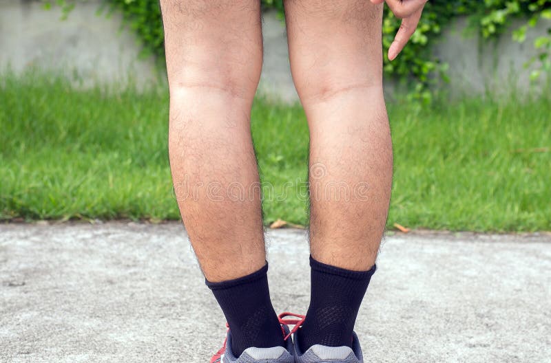 Equipez La Forme A Jambes Arquees De Jambe Des Jambes Foyer Selectif Image Stock Image Du Genou Patte Equipez La Forme A Jambes Arquees De Jambe Des Jambes Foyer Selectif Image Stock Image Du Genou Patte