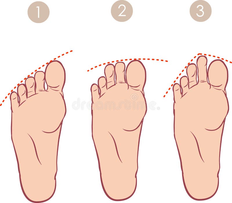 Formlessness of toes