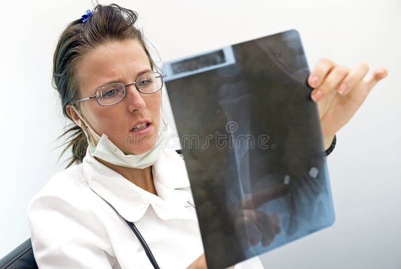 Fracture stock image. Image of staff, specialist, sickness 3976893