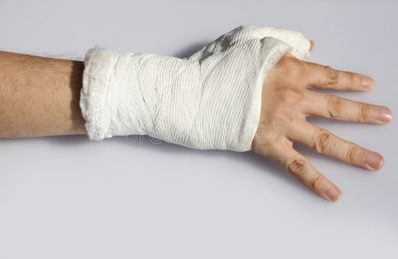 Hand in Cast on White Background Stock Photo - Image of closeup, fracture:  167244908