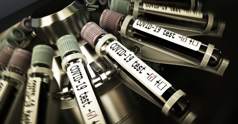 Frascos para injetáveis de sangue numa centrifugadora. teste de covid19 negativo e amostra laboratorial de análises sanguíneas par