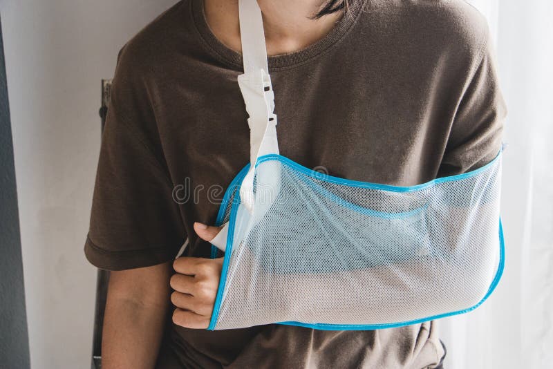 Frau mit dem gebrochenen Arm, der einen Armriemen trägt Frau, die einen Arm trägt stockbilder Frau mit dem gebrochenen Arm, der einen Armriemen trägt Frau, die einen Arm trägt stockbilder