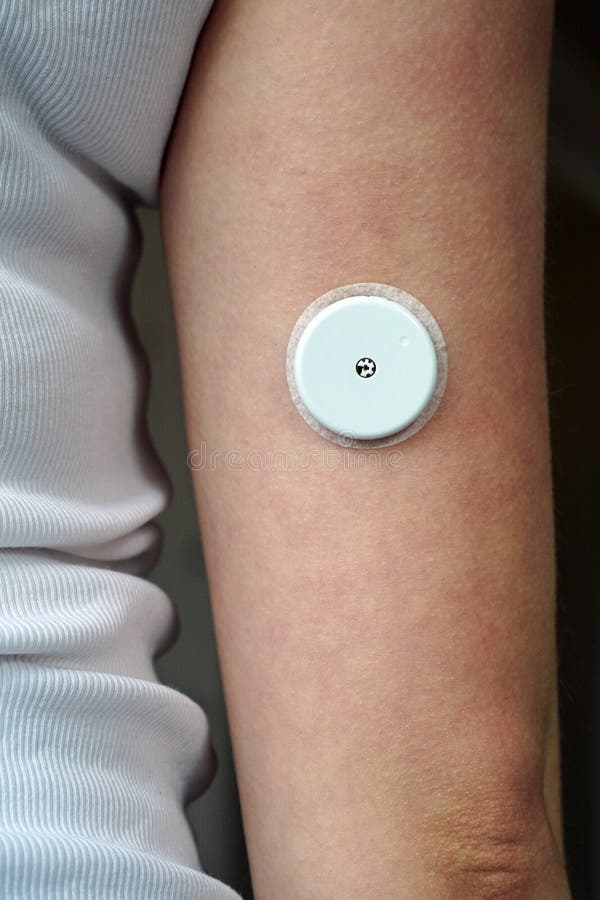 FreeStyle Libre Sensor on an arm