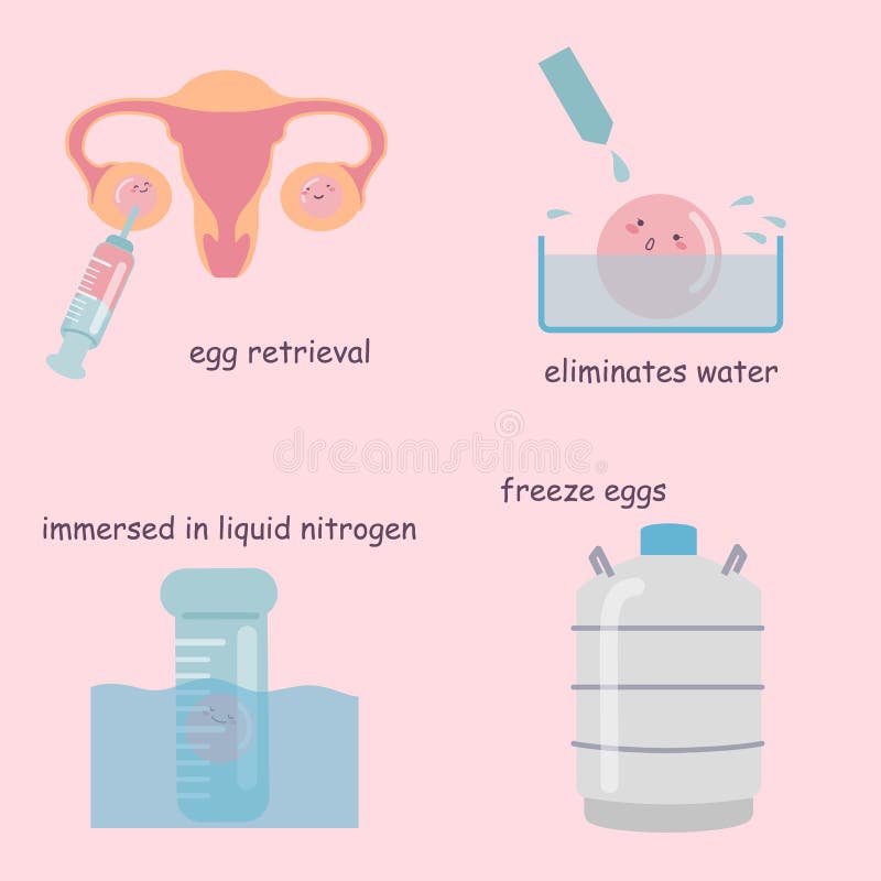 Freezing egg process. Detailed infographic showing laboratory Freezing egg