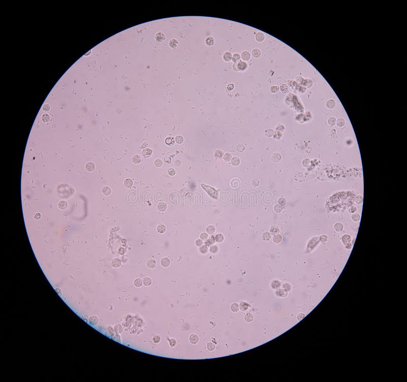 Fresh Bacteria In Urine Stock Photo Image Of Microbe 59434368 fresh-bacteria-in-urine-stock-photo-image-of-microbe-59434368