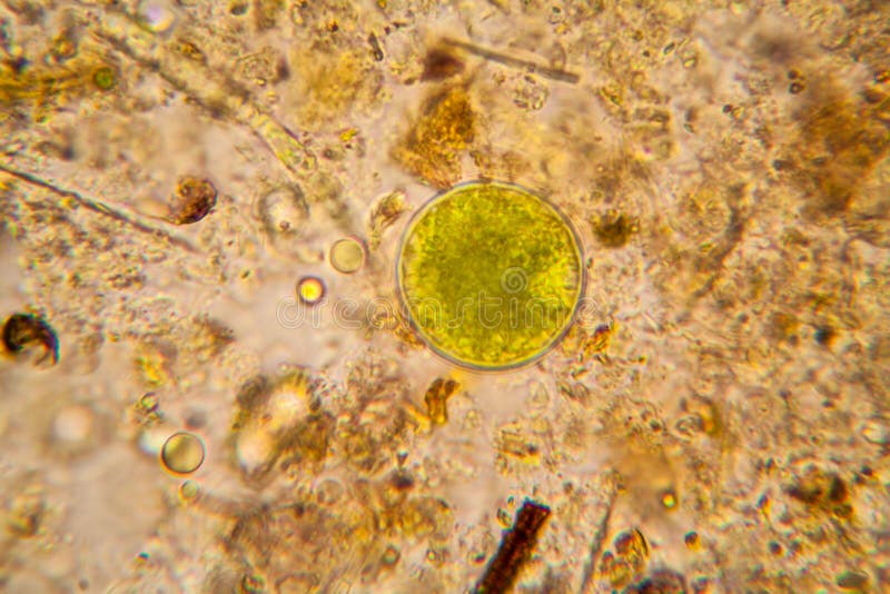 Pond Water Plankton and Algae at the Microscope Stock Image Image of
