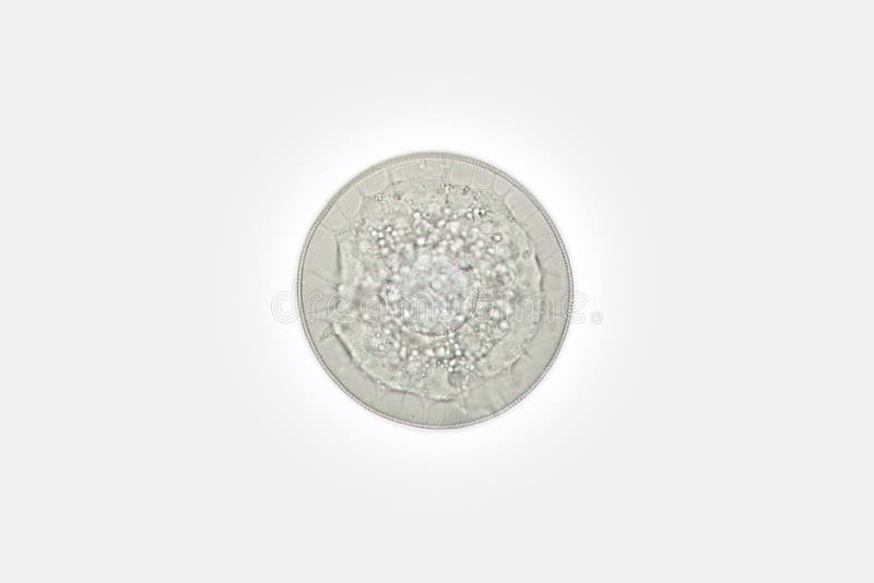 Freshwater phytoplankton round diatom algae Stephanodiscus by microscope. Bacillariophyta Cyclotella kutzingiana royalty free stock photos