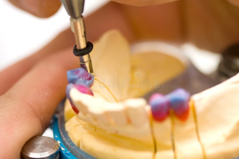 Funcionamento do técnico dental imagem de stock Funcionamento do técnico dental imagem de stock