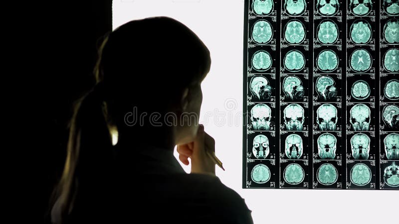 Fundersam kvinnlig doktor som analyserar hjärnbildläsningen, medicinsk forskning, svårt fall arkivbilder Fundersam kvinnlig doktor som analyserar hjärnbildläsningen, medicinsk forskning, svårt fall arkivbilder