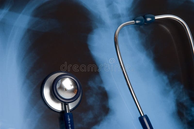 Stethoscope on Xray photo background. Stethoscope on Xray photo background