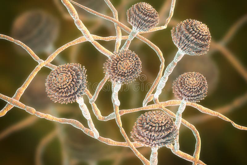 Pilze, Schwarz schimmel welche a verursachen pulmonal infektionen, aus Gehirn a lunge,  dreidimensional illustrationen.