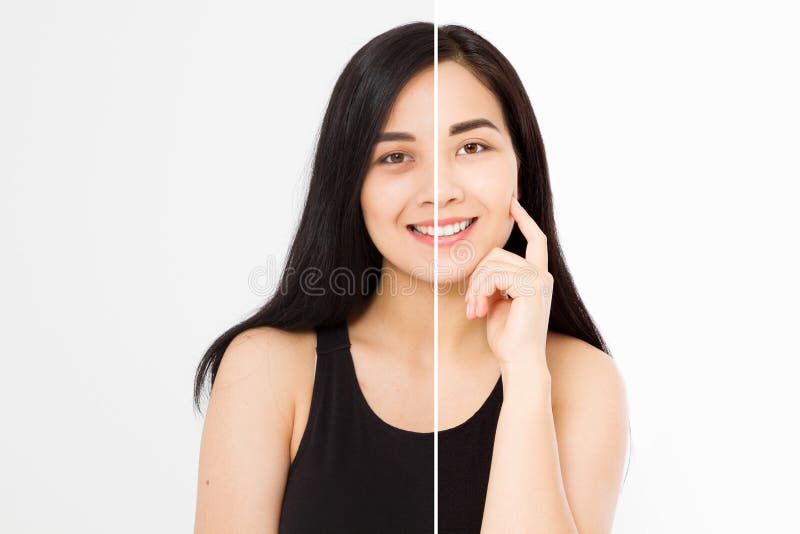 Before after asian woman face closeup isolated on white background. Before-after skin dark circles under eyes. Face care and cosmetic treatment. Before after asian woman face closeup isolated on white background. Before-after skin dark circles under eyes. Face care and cosmetic treatment