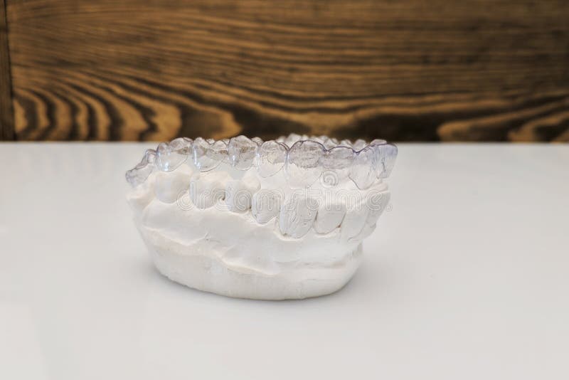 Ganci o aligner di Inivisalign Un modo avere un bello sorriso ed i denti bianchi Sostegni dentari di plastica invisibili dei dent immagini stock libere da diritti Ganci o aligner di Inivisalign Un modo avere un bello sorriso ed i denti bianchi Sostegni dentari di plastica invisibili dei dent immagini stock libere da diritti