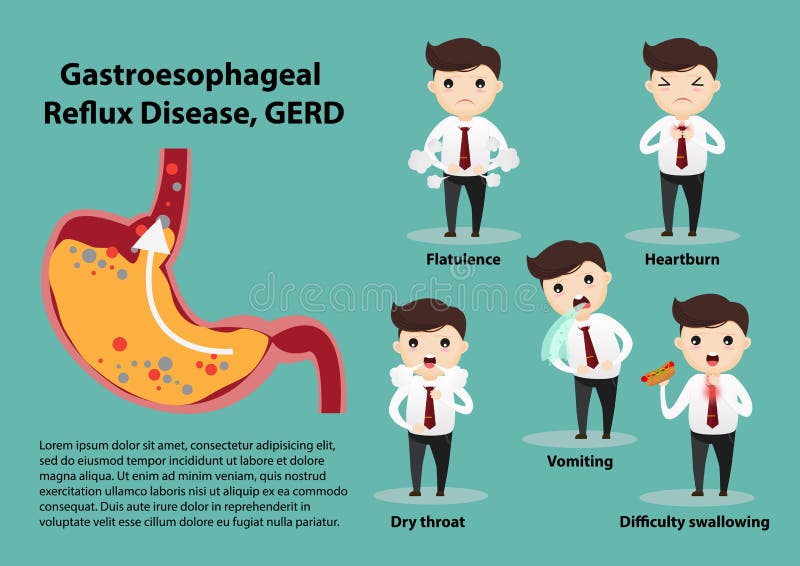Gastro-Esophageal Reflux Disease GERD royalty free illustration Gastro-Esophageal Reflux Disease GERD royalty free illustration