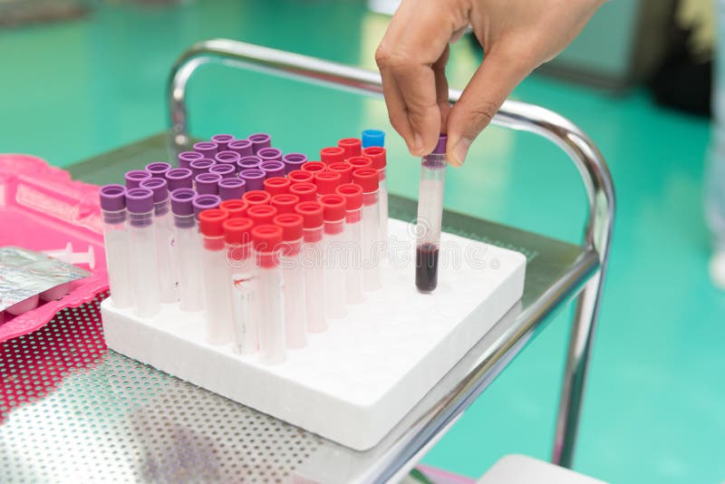 Ge f?rsta erfarenhet provet mot efterkrav i provr?r p? laboratoriumet av sjukhuset Fysisk unders?kning och sjukv?rdbegrepp arkivbild Ge f?rsta erfarenhet provet mot efterkrav i provr?r p? laboratoriumet av sjukhuset Fysisk unders?kning och sjukv?rdbegrepp arkivbild