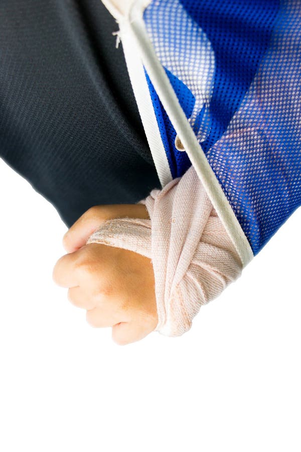 Gebrochener Arm Der Unschärfe Kind Mit Verband Stockfoto Bild von