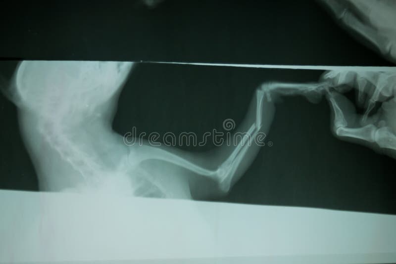 Erste Hilfe, Verdrehtes Bein Unfall Auf Einem Gebirgspfad Stockbild