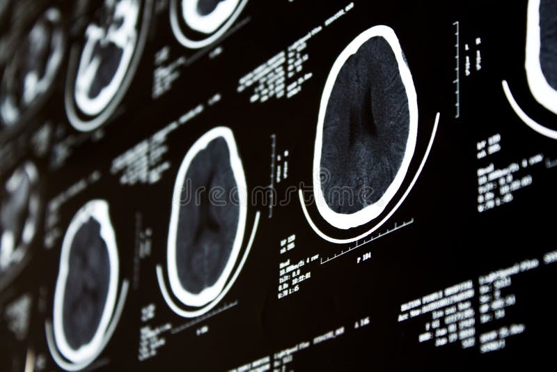 Gegevens verwerkte CT van de Tomografie royalty-vrije stock afbeelding Gegevens verwerkte CT van de Tomografie royalty-vrije stock afbeelding