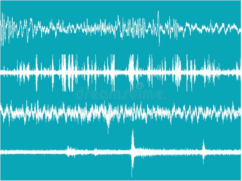 Realistic illustration of the brain waves activity. Realistic illustration of the brain waves activity.