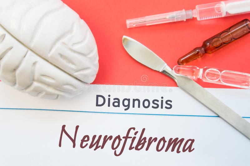 Gehirnzahl, chirurgisches Skalpell, Spritze und Phiolen, die um Titel Diagnose Neurofibroma liegen Konzeptfoto für Diagnose, chir stockfotografie Gehirnzahl, chirurgisches Skalpell, Spritze und Phiolen, die um Titel Diagnose Neurofibroma liegen Konzeptfoto für Diagnose, chir stockfotografie