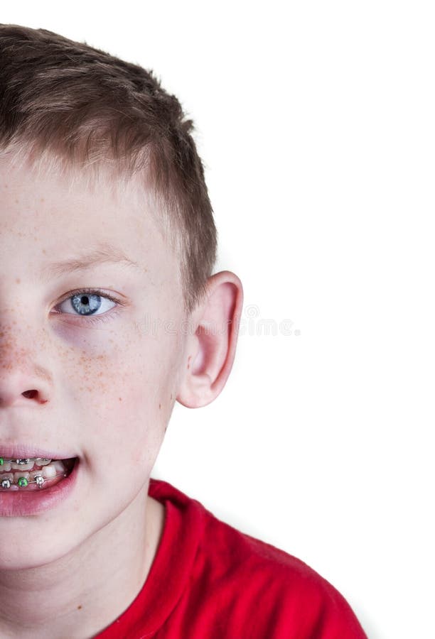 Gelukkige Jongen met steunen royalty-vrije stock foto Gelukkige Jongen met steunen royalty-vrije stock foto