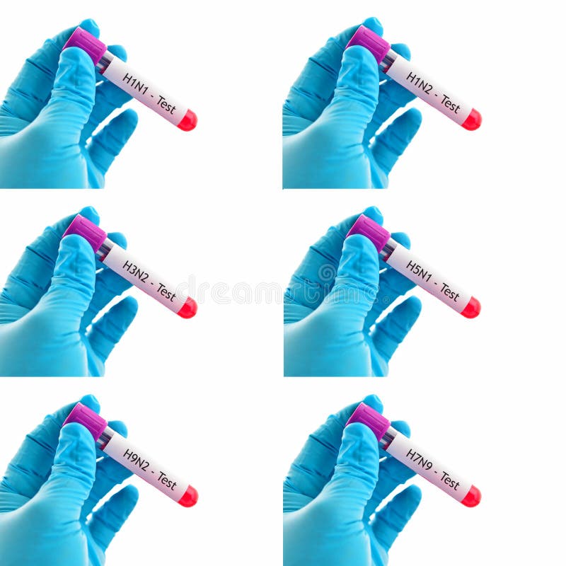 Gemengd van bloedmonsterbuizen voor de test van het griepvirus stock fotografie Gemengd van bloedmonsterbuizen voor de test van het griepvirus stock fotografie