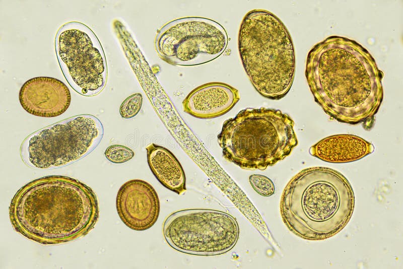Wurmeier stockbild. Bild von mikroskopie, plattfisch - 70356359