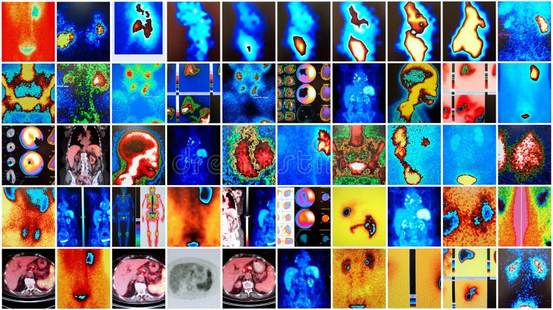 General nuclear medicine