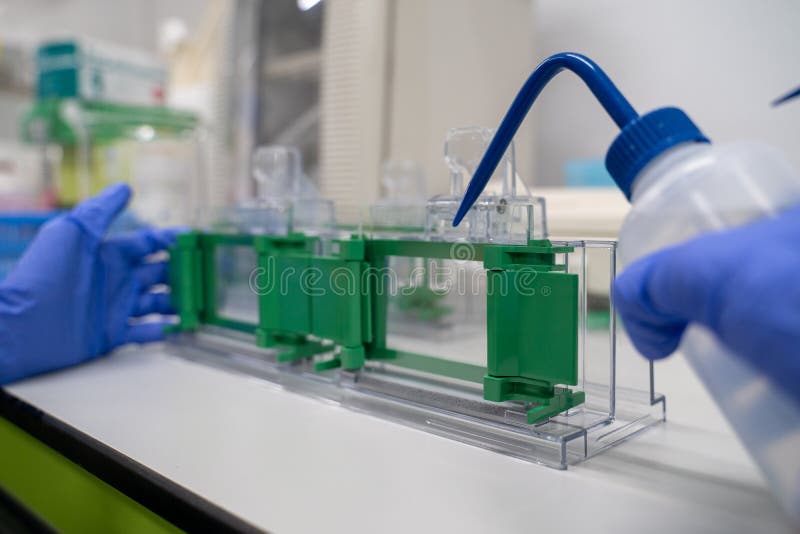The General Process Preparation for Protein Levels Detection is Using