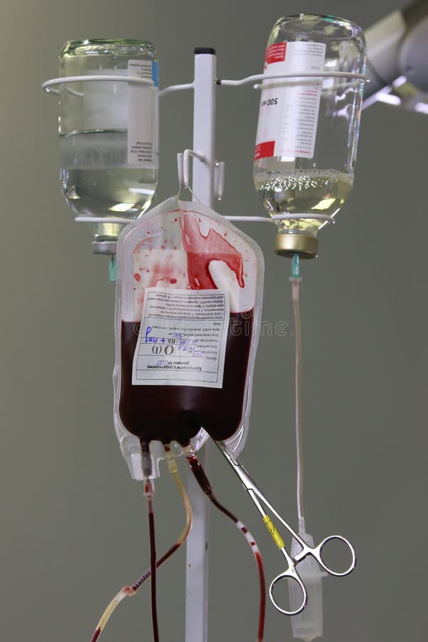 Gespendete Bluttransfusion lizenzfreies stockbild Gespendete Bluttransfusion lizenzfreies stockbild