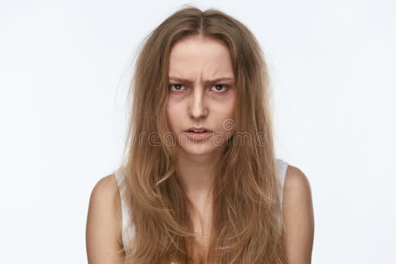 Giovane donna esaurita con le contusioni sotto gli occhi