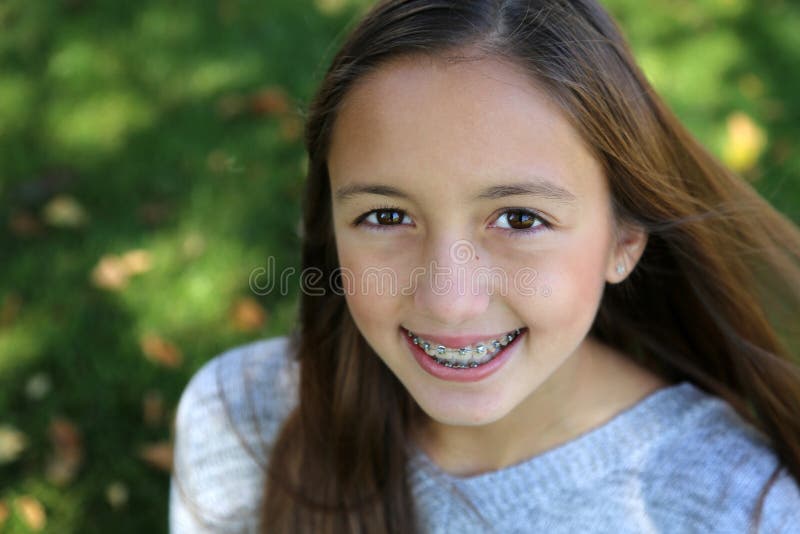 Girl with braces stock photo. Image of brunette, head - 47911280