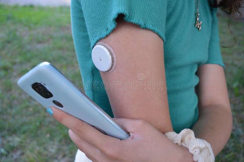 Girl with diabetes is reading the glucose levels from a white sensor on arm using mobile phone application.
