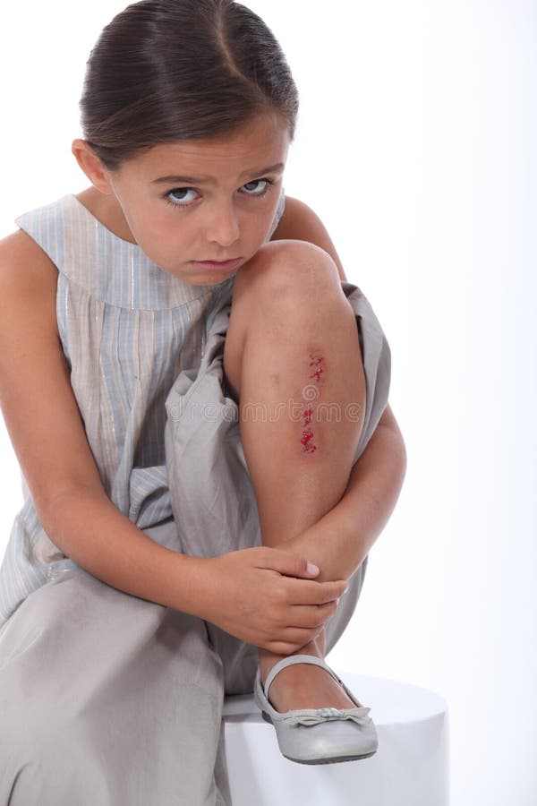 Girl with an injured leg stock photo. Image of blood 27810868