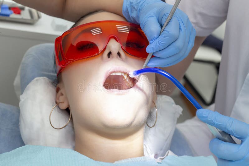 Girl patient at the reception at dentist. treatment of carious tooth. the girl lies on the dental chair with his mouth open. A den royalty free stock photo Girl patient at the reception at dentist. treatment of carious tooth. the girl lies on the dental chair with his mouth open. A den royalty free stock photo