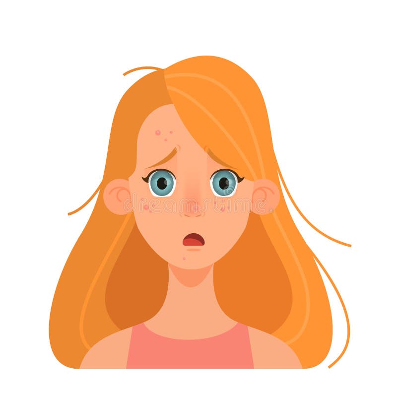 Girl with pimple on the face. Sad woman, skin problem. vector illustration