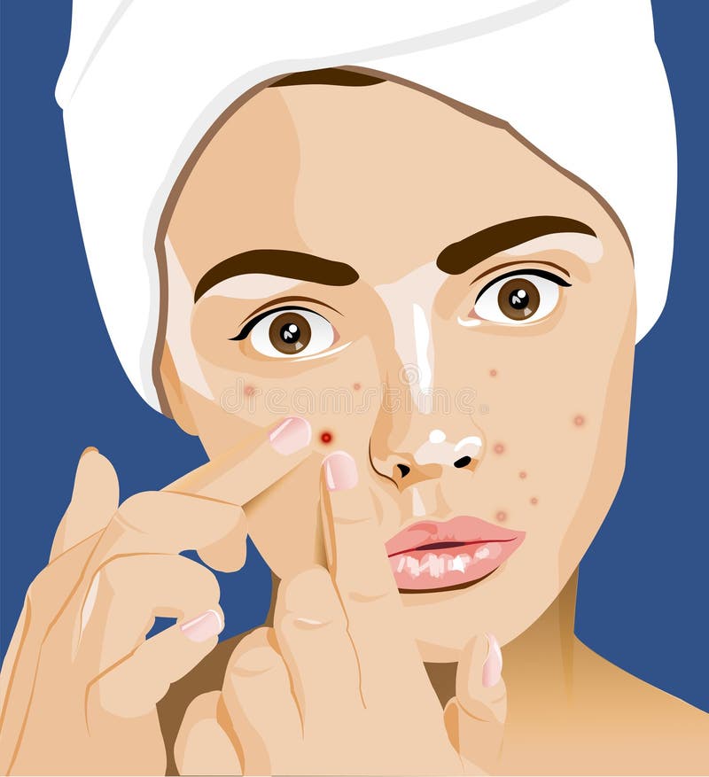  Acne  pimples stock vector Illustration of layers 