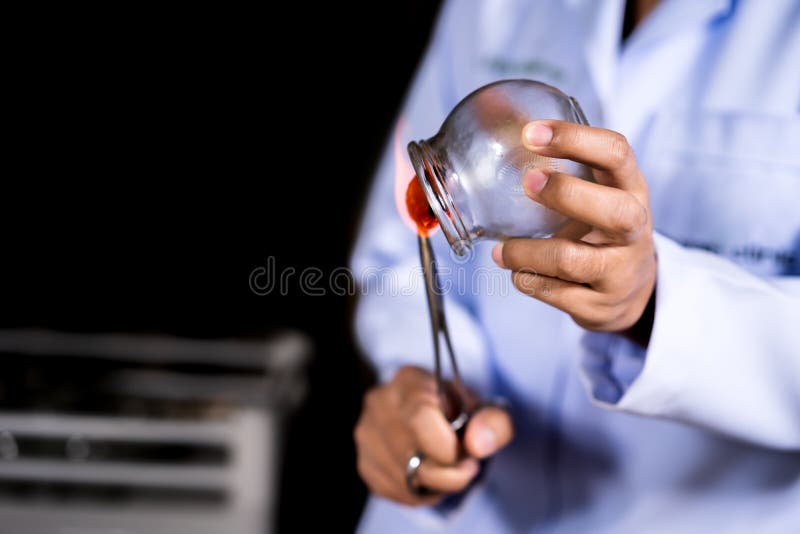 Glass Cup with Fire for Cupping Treatment on Female Back Stock Image