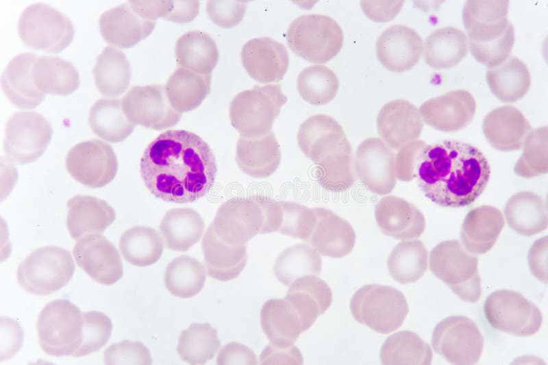 Globules blancs dans la calomnie de sang image stock Globules blancs dans la calomnie de sang image stock